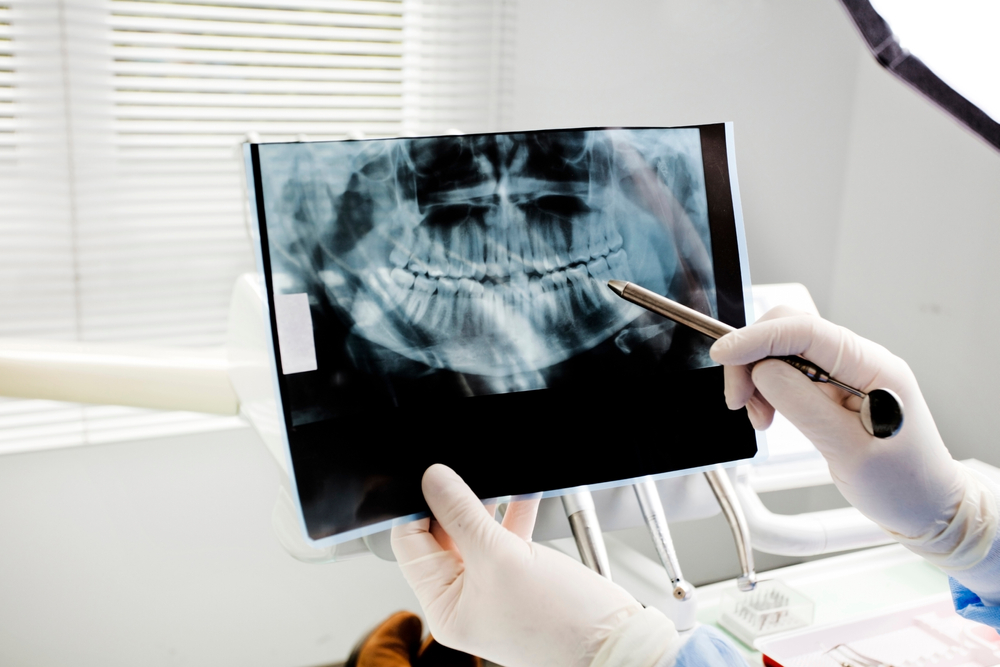 radiografie dentara bucuresti