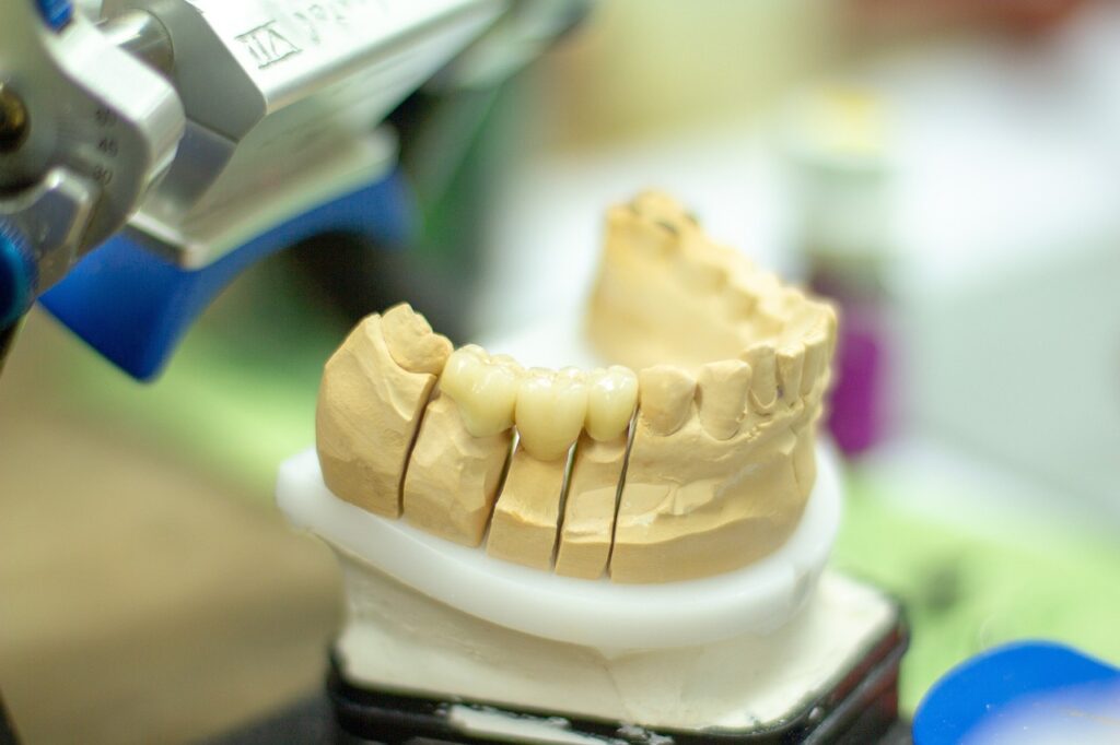 ingrijire coroane dentare
