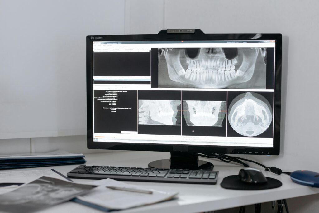 Radiografie Dentara Bucuresti